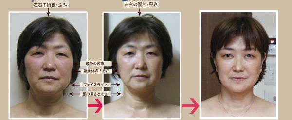 フェイシャル
